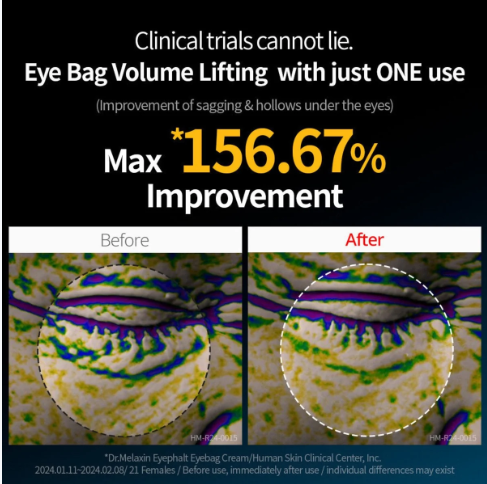 Dr Melaxin - Eyephalt Eyecream